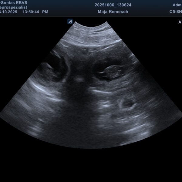 Erstes Ultraschallbild Maja C-Wurf